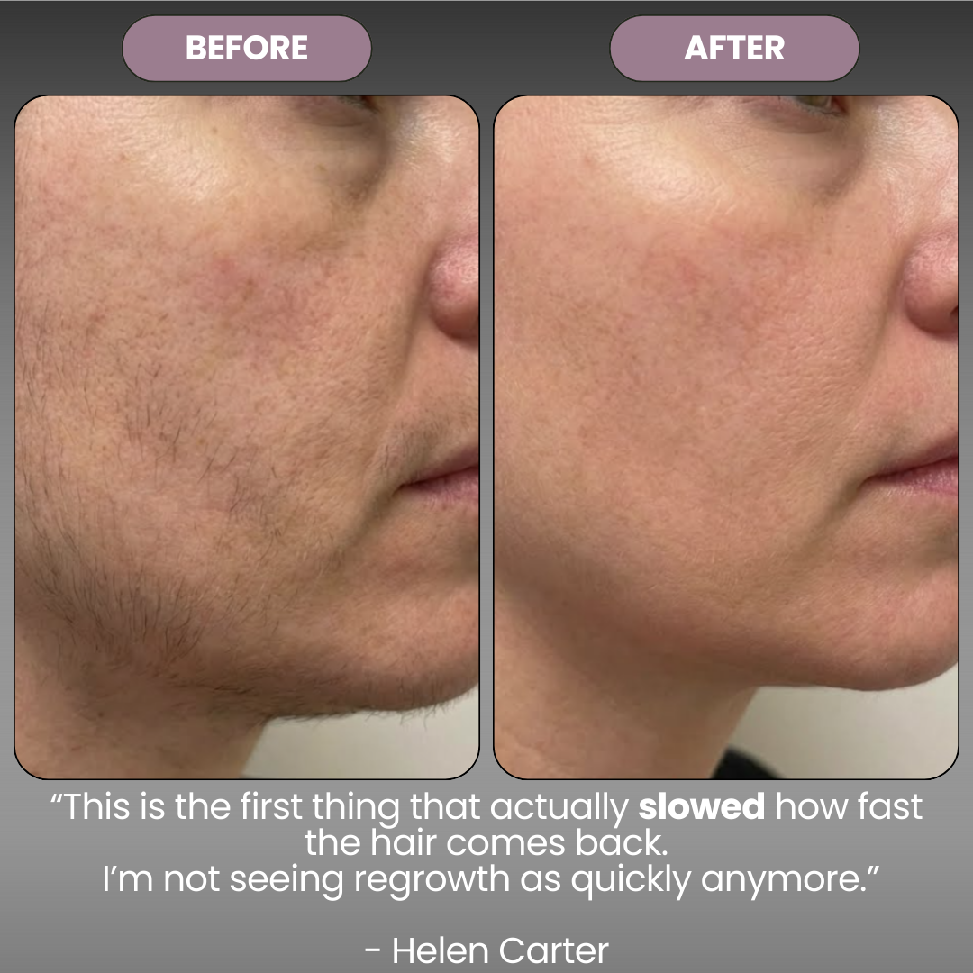 Cyperus Rotondus Skin Serum