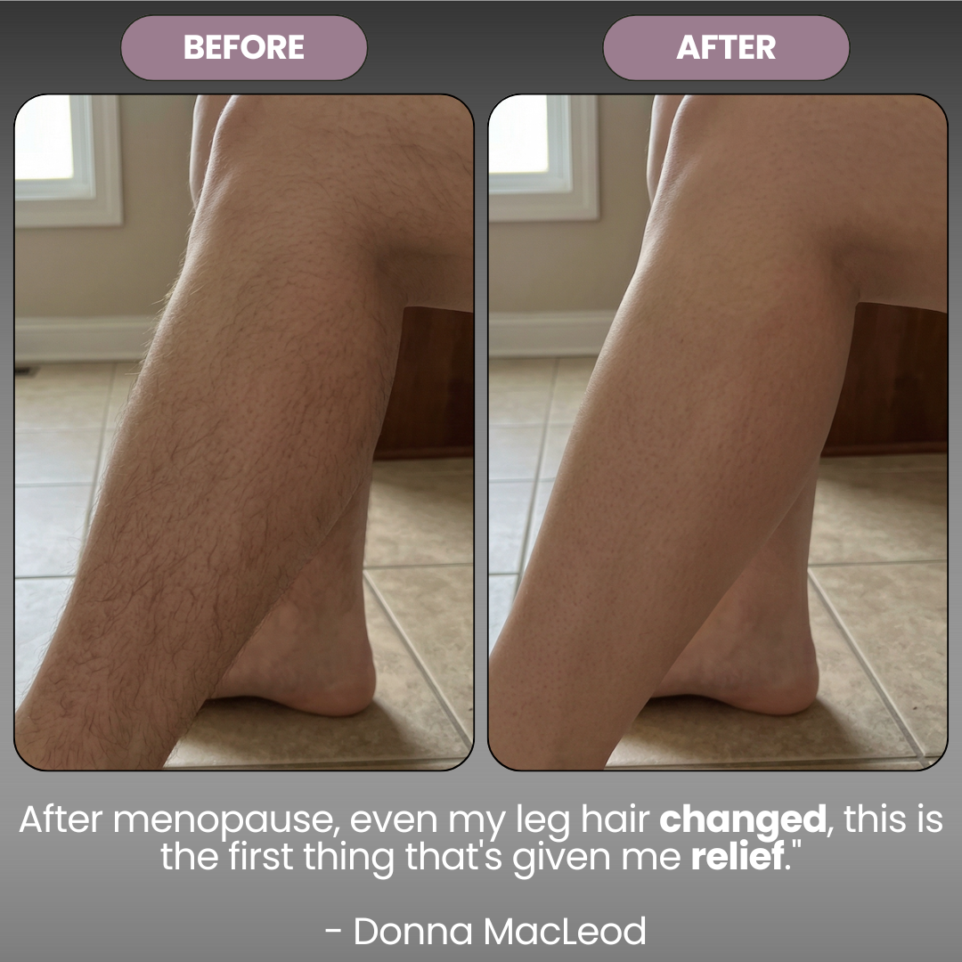 Cyperus Rotondus Skin Oil