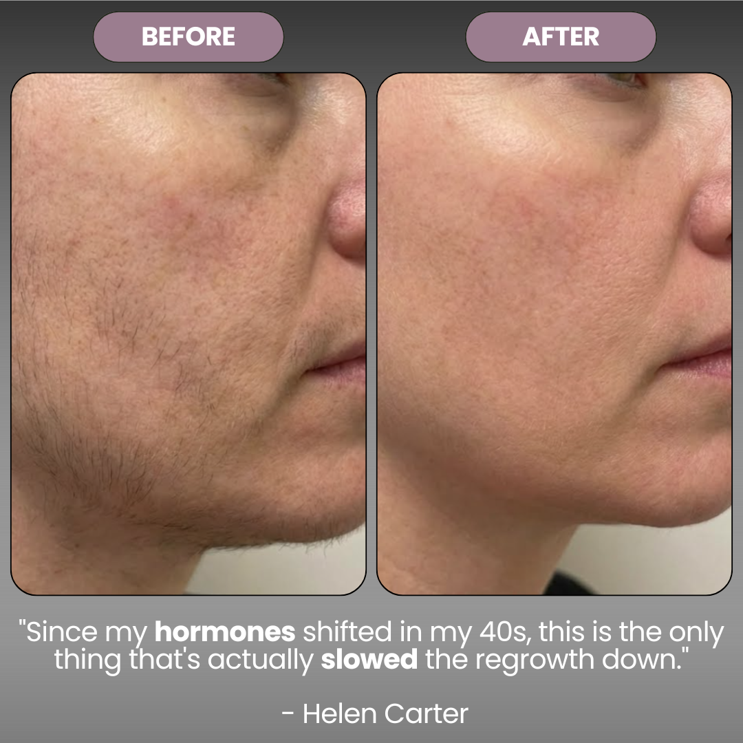 Cyperus Rotondus Skin Oil