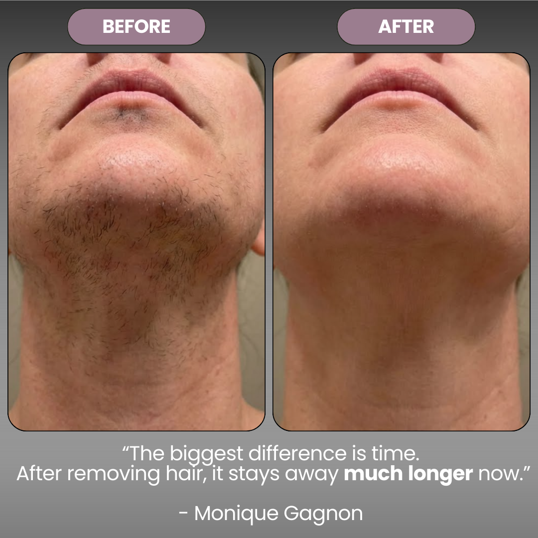 Cyperus Rotondus Skin Serum