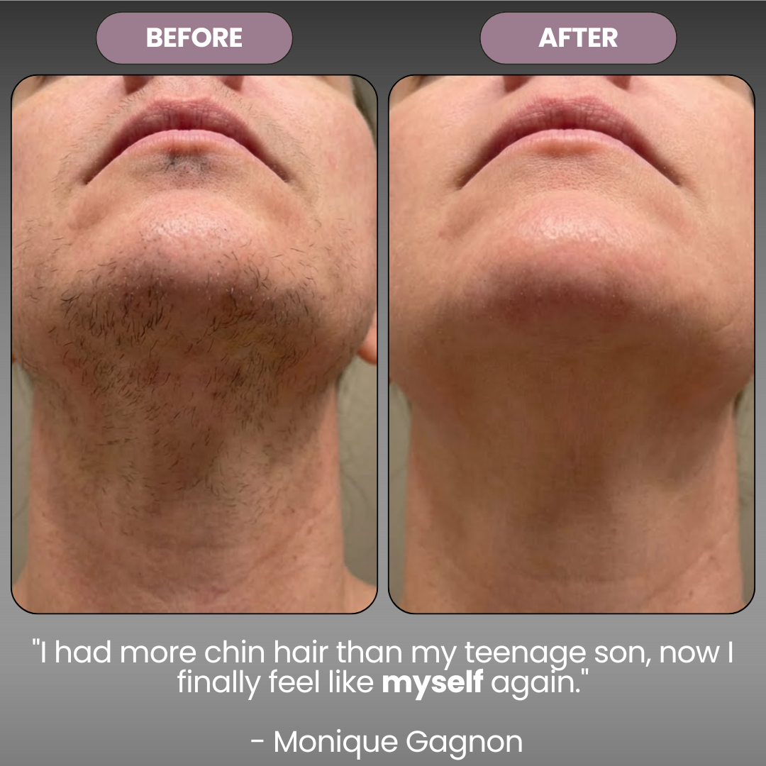 Cyperus Rotondus Skin Oil