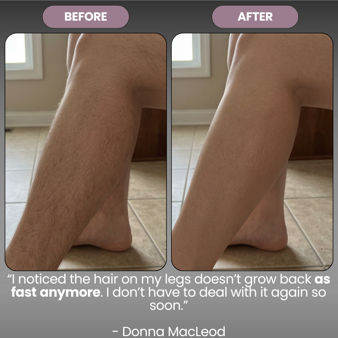 Cyperus Rotondus Skin Serum