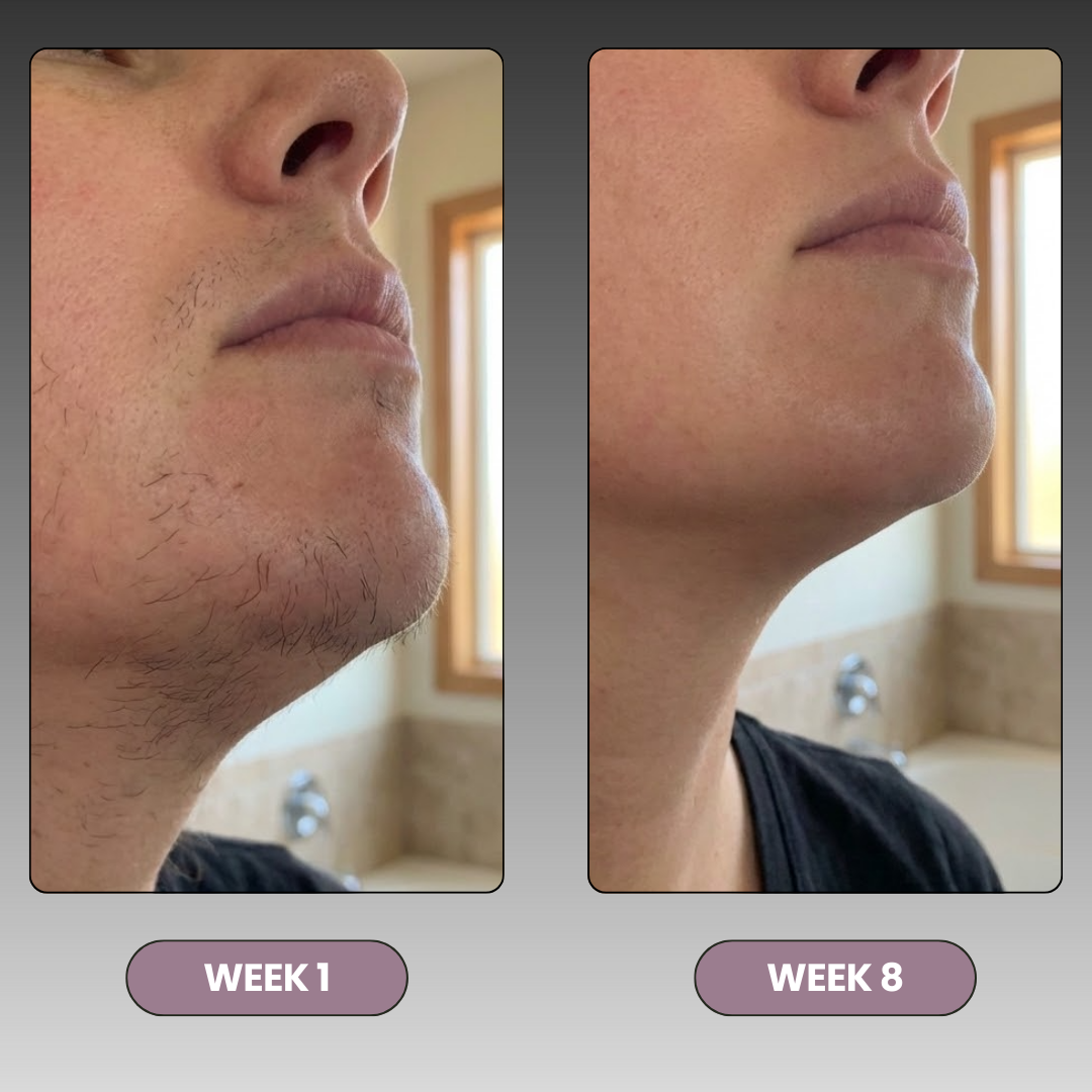 Hair Removal Epilator